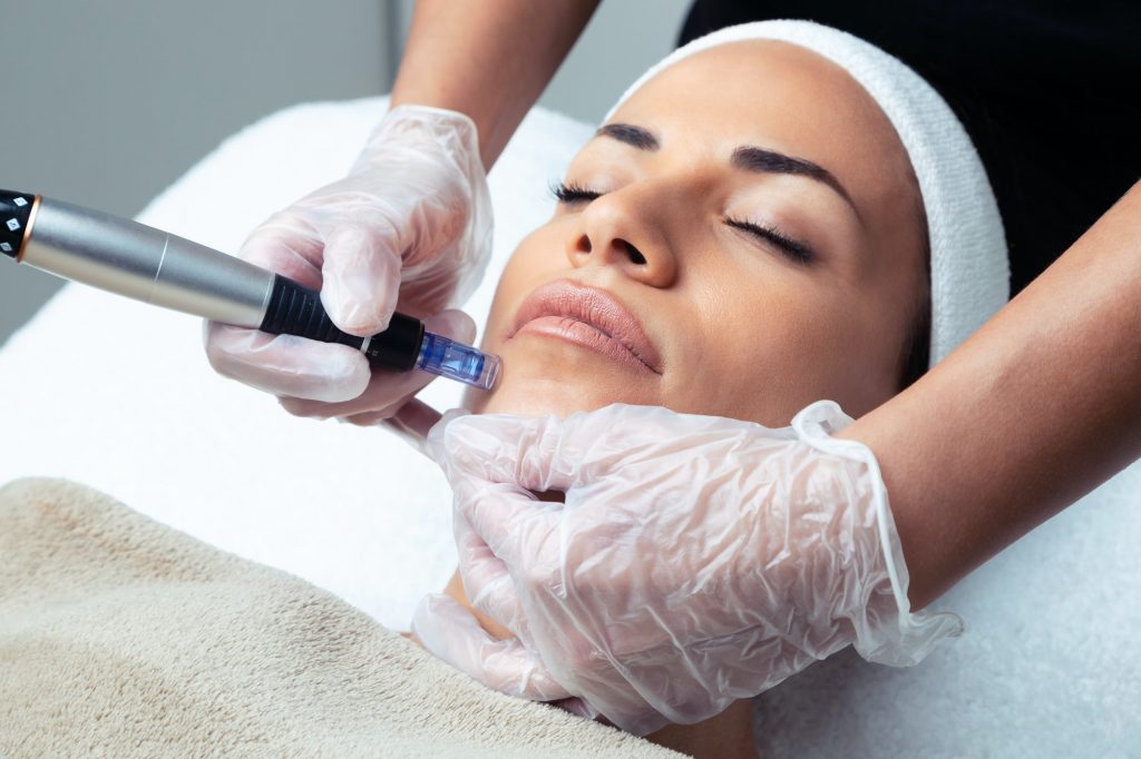 skin needling near me