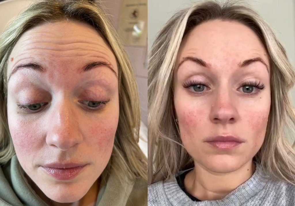 anti wrinkle treatments